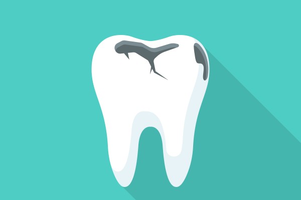 How An Endodontist Treats Cracked Teeth